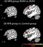 Frontiers | Enhancing Motor Network Activity Using Real-Time Functional ...