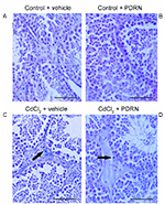 Frontiers | Polydeoxyribonucleotide, An Adenosine-A2A Receptor Agonist ...