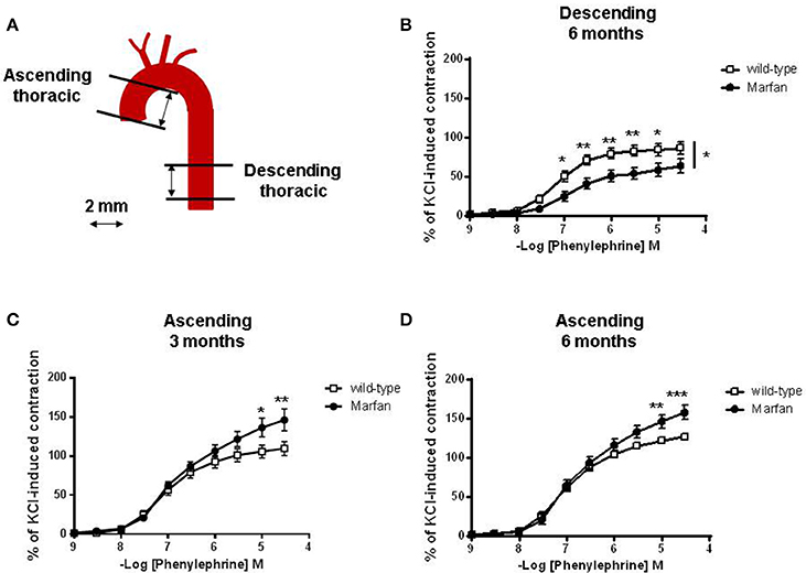 differences in the thoracic aorta by region and sex in a murine