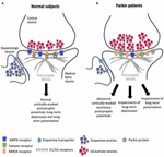 early dyskinesias in parkinson"s disease patients with parkin