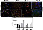 lactic acidosis promotes mitochondrial biogenesis in lung