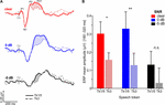 effects of noise on the behavioral and neural ca