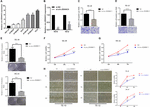 Frontiers Circ ZDHHC5 Accelerates Esophageal Squamous Cell Carcinoma