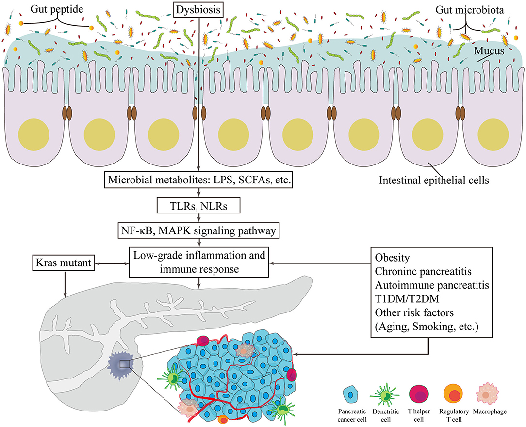 Frontiers Gut Microbiota Its Potential Roles In Pancreatic Cancer