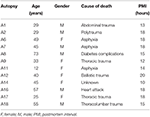 drug-resistant temporal lobe epilepsy alters the expression and