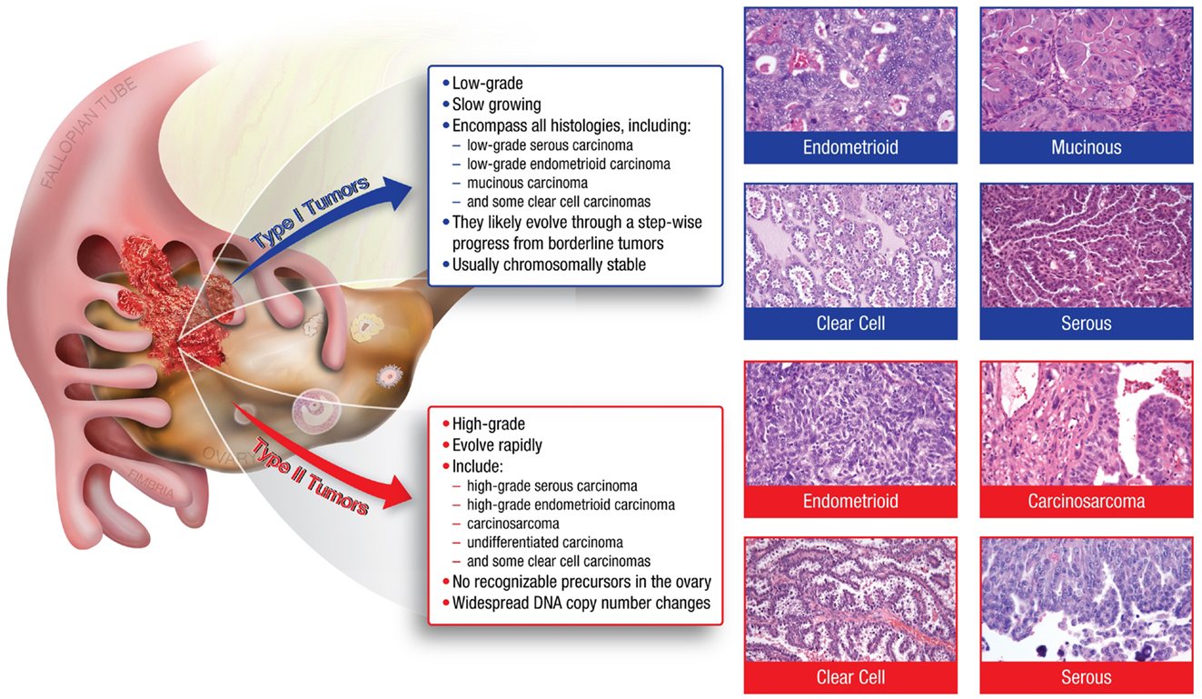 Frontiers Modeling High Grade Serous Carcinoma How Converging 