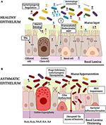 cells (small airways) that form pseudostratified or columnar and