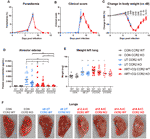 ccr2 is dispensable for disease resolution but required for the