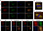 Frontiers RBM14 Modulates Tubulin Acetylation And Regulates Spindle