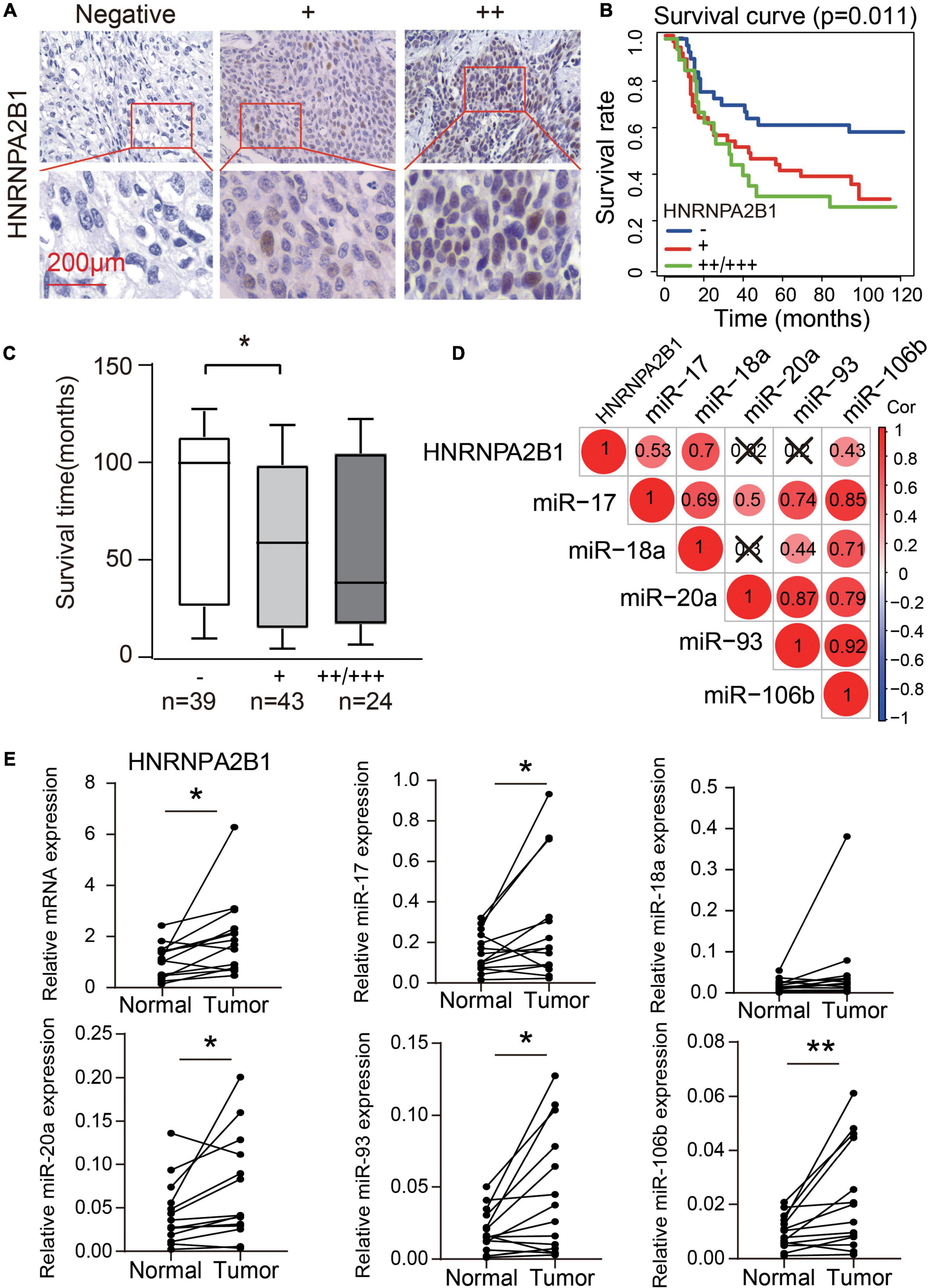 Frontiers HNRNPA2B1 Affects The Prognosis Of Esophageal Cancer By