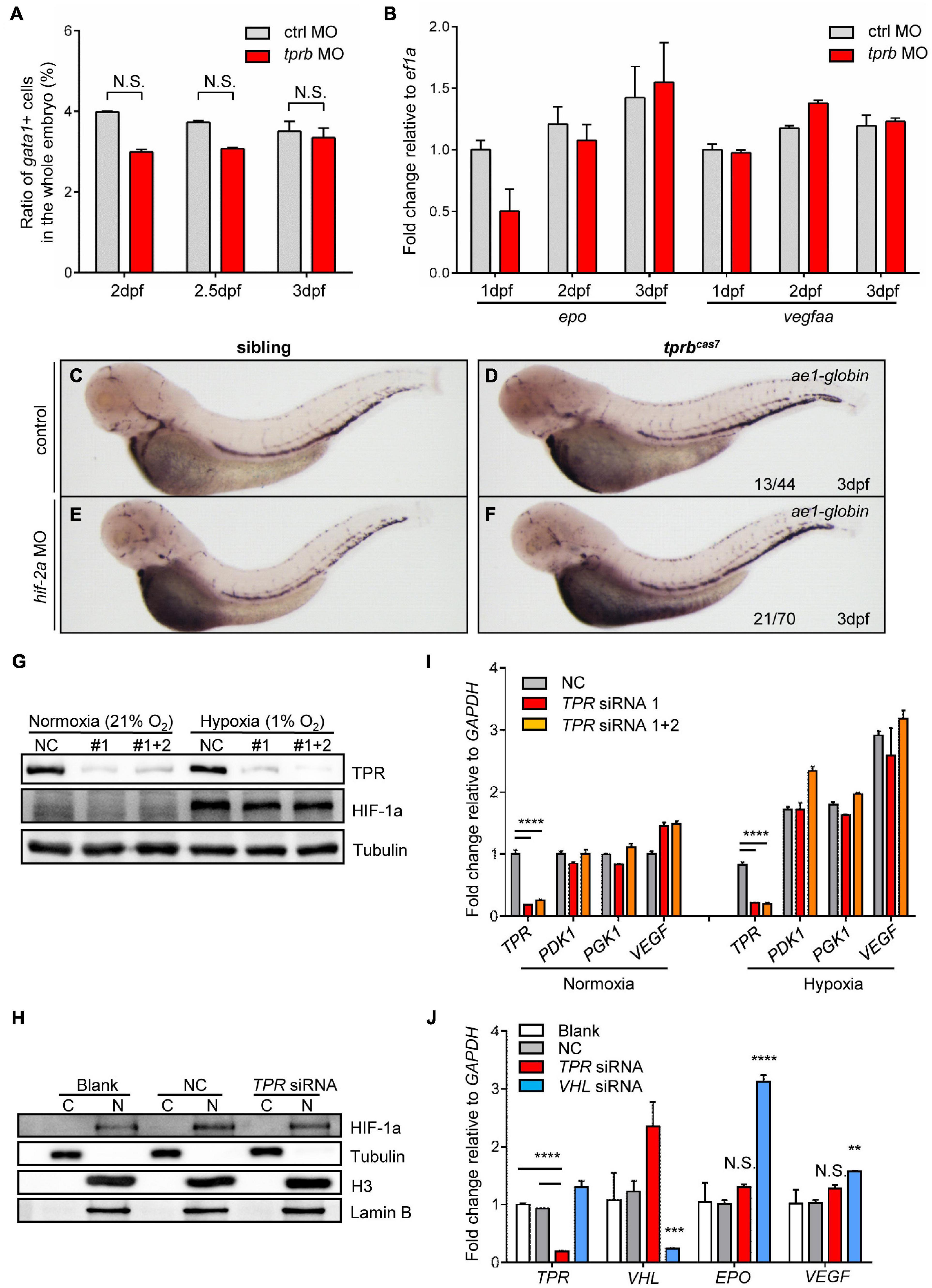 Frontiers Tpr Deficiency Disrupts Erythroid Maturation With Impaired