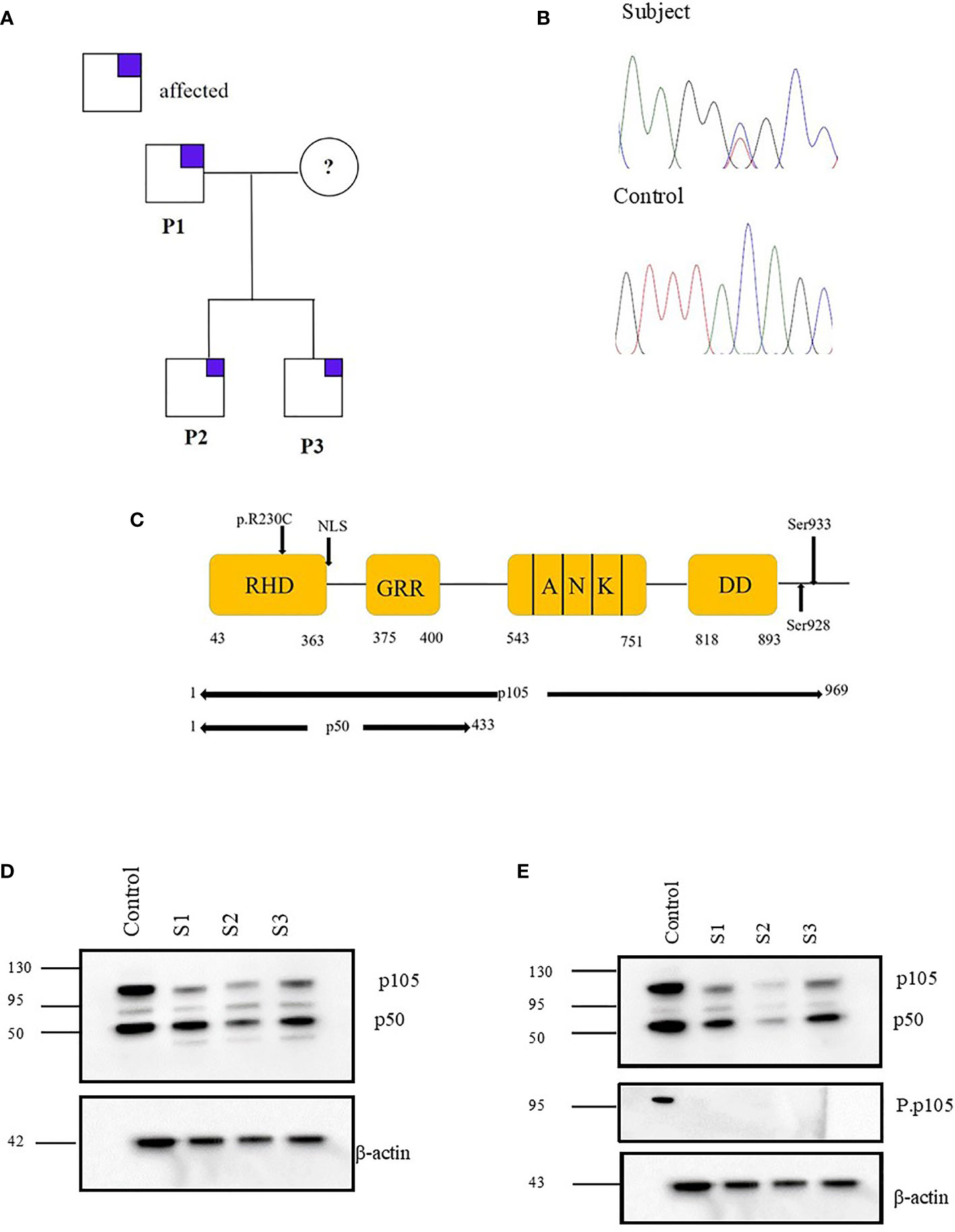 Frontiers Vulnerability To Meningococcal Disease In Immunodeficiency