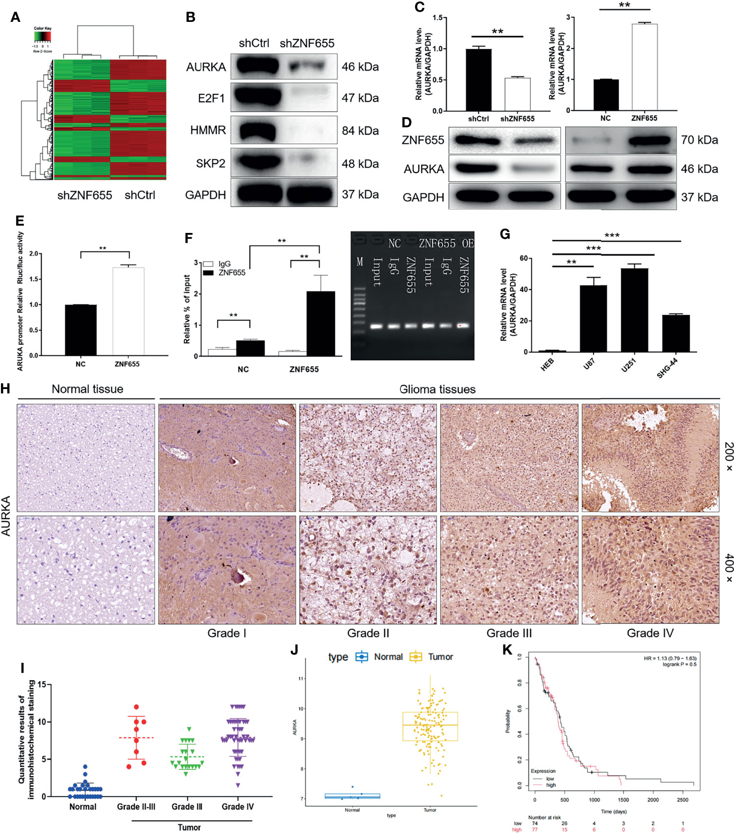 Frontiers Znf Promotes The Progression Of Glioma Through