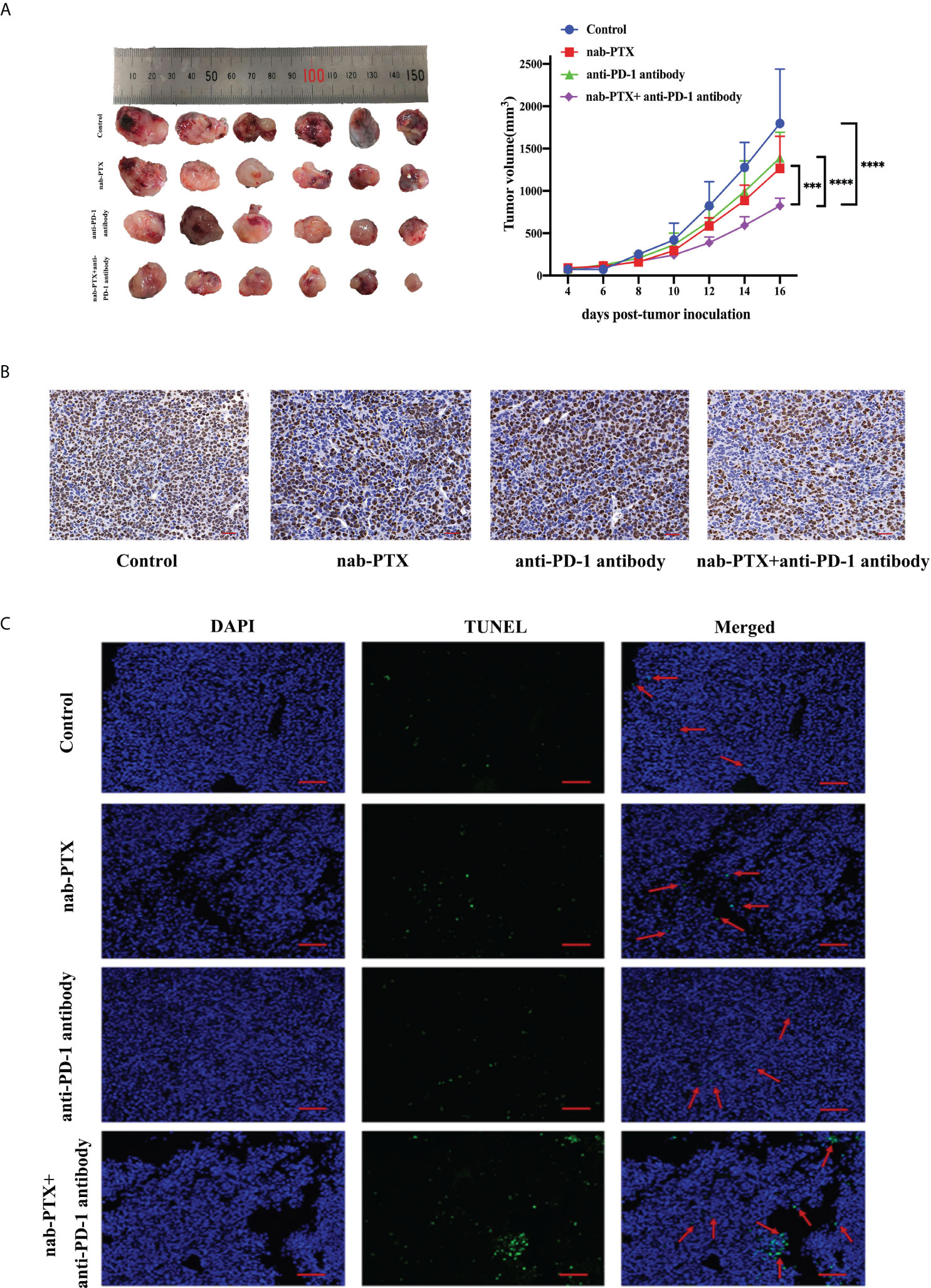 Frontiers Synergistic Effects Of Nab Ptx And Anti Pd Antibody