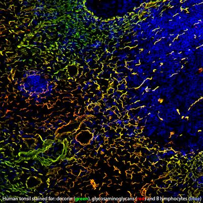 Cover image for research topic "Proteoglycans and Glycosaminoglycan Modification in Immune Regulation and Inflammation"