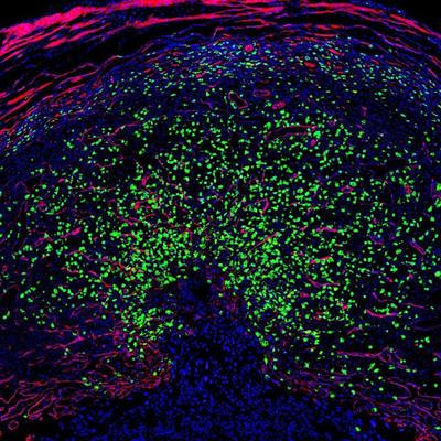 Cover image for research topic "Hype or Hope: New Frontiers in Endometrial Research"