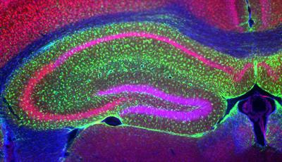 Cover image for research topic "Glial Dysfunction in Epileptogenesis"