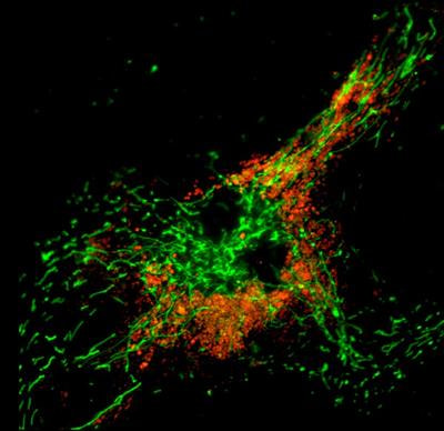 Cover image for research topic "Organelles Relationships and Interactions: a Cancer Perspective"