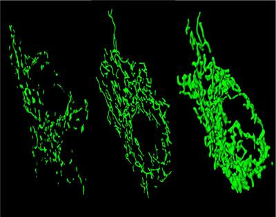 Cover image for research topic "Mitochondrial Remodeling and Dynamic Inter-Organellar Contacts in Cardiovascular Physiopathology"