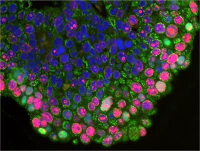 Cover image for research topic "Annual Meeting of the International Society of Cancer Metabolism (ISCaM)-
Cancer Metabolic Rewiring: Mapping the Road to Clinical Translation"