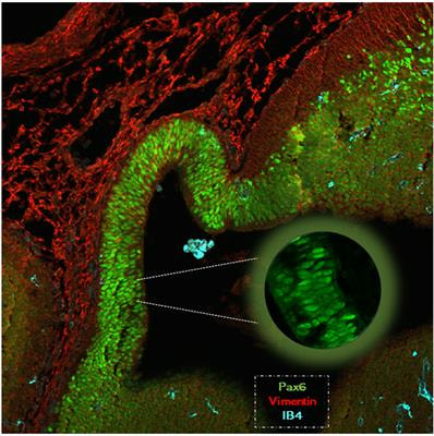 Cover image for research topic "Transcription Regulation - Brain Development and Homeostasis - A Finely Tuned and Orchestrated Scenario in Physiology and Pathology"