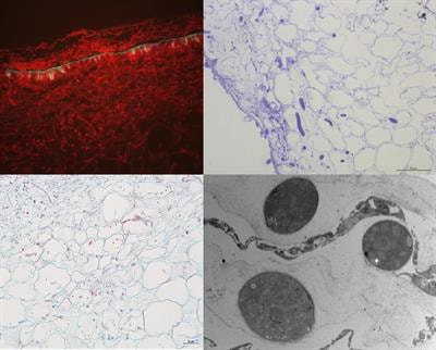 Cover image for research topic "Necrotrophic Fungal Plant Pathogens"