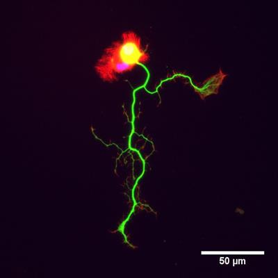 Cover image for research topic "Rare Neurodegenerative Disorders: From Molecular Pathways to Therapeutic Strategies"