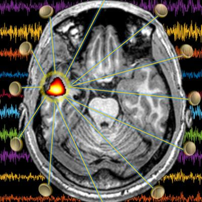 Cover image for research topic "Advances and Applications of the EEG-fMRI Technique on Epilepsies"