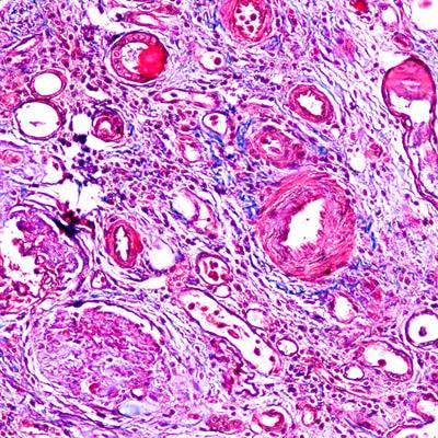 Cover image for research topic "Immune Landscape of Kidney Pathology"