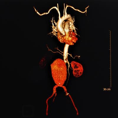 Cover image for research topic "Multimodality Imaging in Chronic Coronary Syndrome"