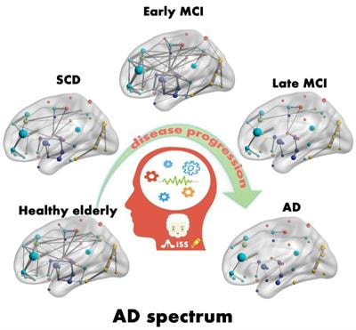 Cover image for research topic "Neuroimaging Biomarkers and Cognition in Alzheimer’s disease Spectrum"