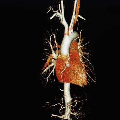 Cover image for research topic "Advances in Cardiac Imaging and Heart Failure Management"