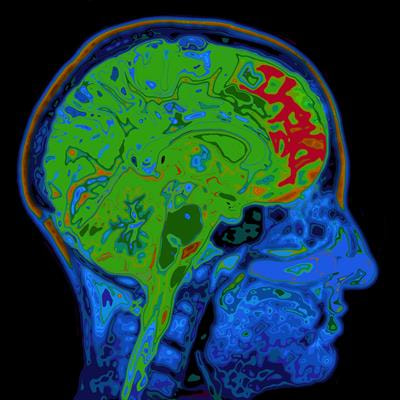 Cover image for research topic "Cardiovascular Factors and Brain Health: Measurement, outcomes and future enquiry"