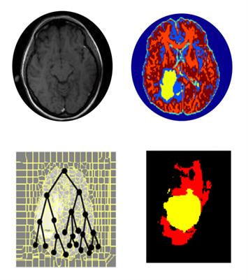 Cover image for research topic "Computational Radiomics for Cancer Characterization"