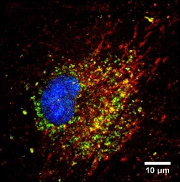 Cover image for research topic "Extracellular RNAs as Outside Regulators of Gene Expression in Homeostasis and Pathology"