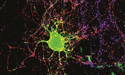 Cover image for research topic "Role of Extracellular Matrix in Neurodevelopment and Neurodegeneration"