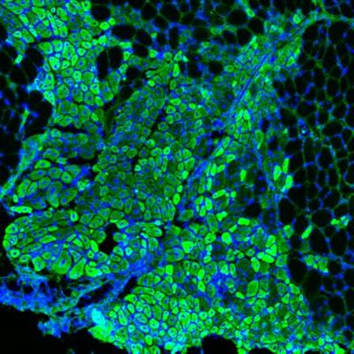 Cover image for research topic "Muscular Dystrophies: Current Therapeutic Advances to Improve and Restore Muscle Homeostasis"