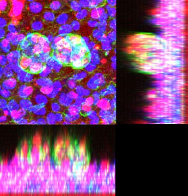 Cover image for research topic "Molecular Mechanisms and New Therapeutic Targets in Epithelial to Mesenchymal Transition (EMT) and Fibrosis, Volume II"