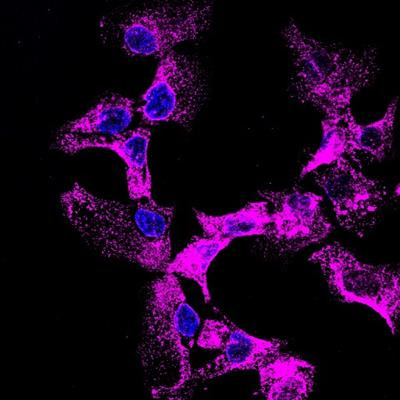 Cover image for research topic "Endolysosomal and Autophagic Dysfunctions as Early Drivers of Neurodegeneration"