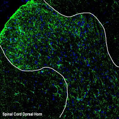 Cover image for research topic "Mechanisms and Models of Musculoskeletal Pain and Nonpharmacological Treatment"