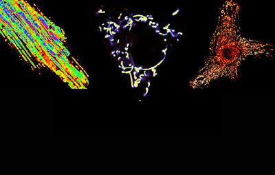 Cover image for research topic "Genomic alteration landscapes of aging, metabolic disorders, and cancer: emerging overlaps and clinical importance"