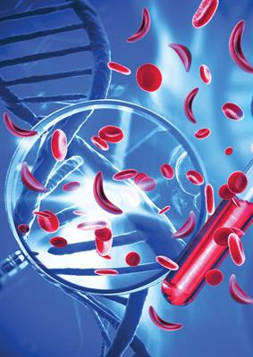 Cover image for research topic "Building Capacity for Sickle Cell Disease Research and Healthcare"