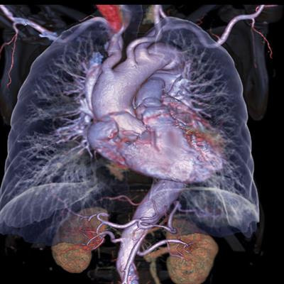 Cover image for research topic "The Heart Lung Disease: A need for novel definitions and understanding of pathological overlaps in the COVID-19 era and beyond"
