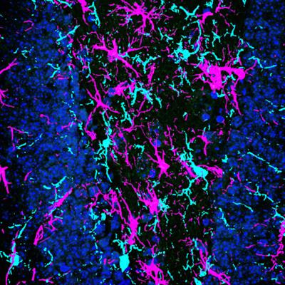 Cover image for research topic "Glial-Targeted Therapeutics for CNS Disease: Getting There from Here"