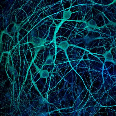 Cover image for research topic "Functional Genomics, Morphology and 
Physiology of Brain Development and Brain Disorders"