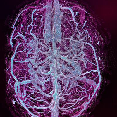 Cover image for research topic "Vascular and Perivascular Contributions to Neurodegeneration"