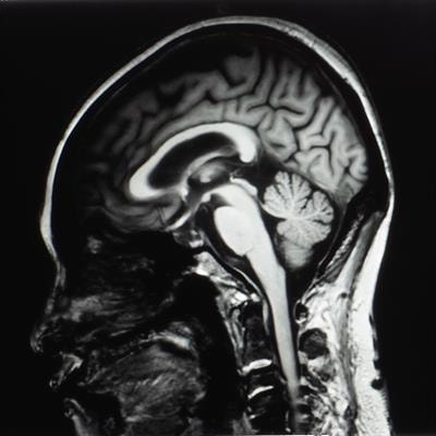 Cover image for research topic "Demonstrating Quality Control (QC) Procedures in fMRI"