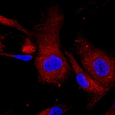 Cover image for research topic "Cancer Stem Cells: Hidden Modulators of Tumor Immune Response"