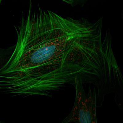 Cover image for research topic "ROS Signaling During Cytoskeleton Dynamics"