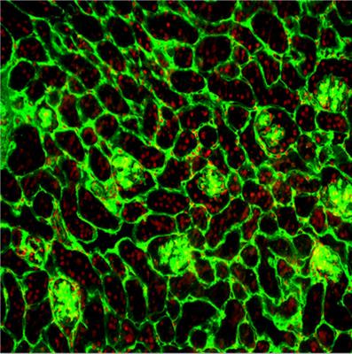 Cover image for research topic "Myriad Types of Cell Death in Nephropathy and Their Veiled Potential"